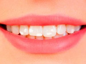 causas de manchas en los dientes