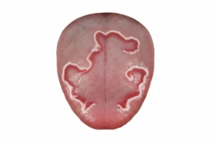 Lengua mapa que es