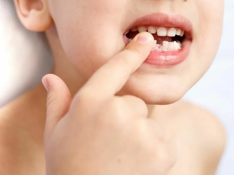 ¿A qué edad se comienzan a caer los dientes de leche?
