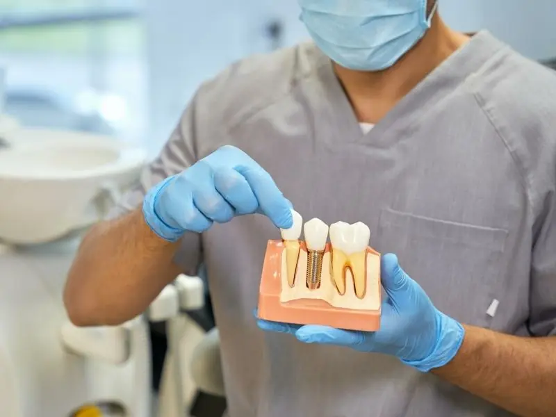 ¿Qué es lo último en implantes dentales?